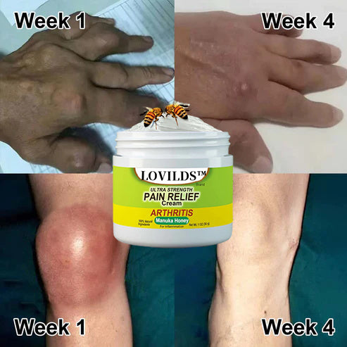 🐝New Zealand Bee Venom Joint and Bone Therapy Advanced Cream⏳Limited time discount of 80%⏳
